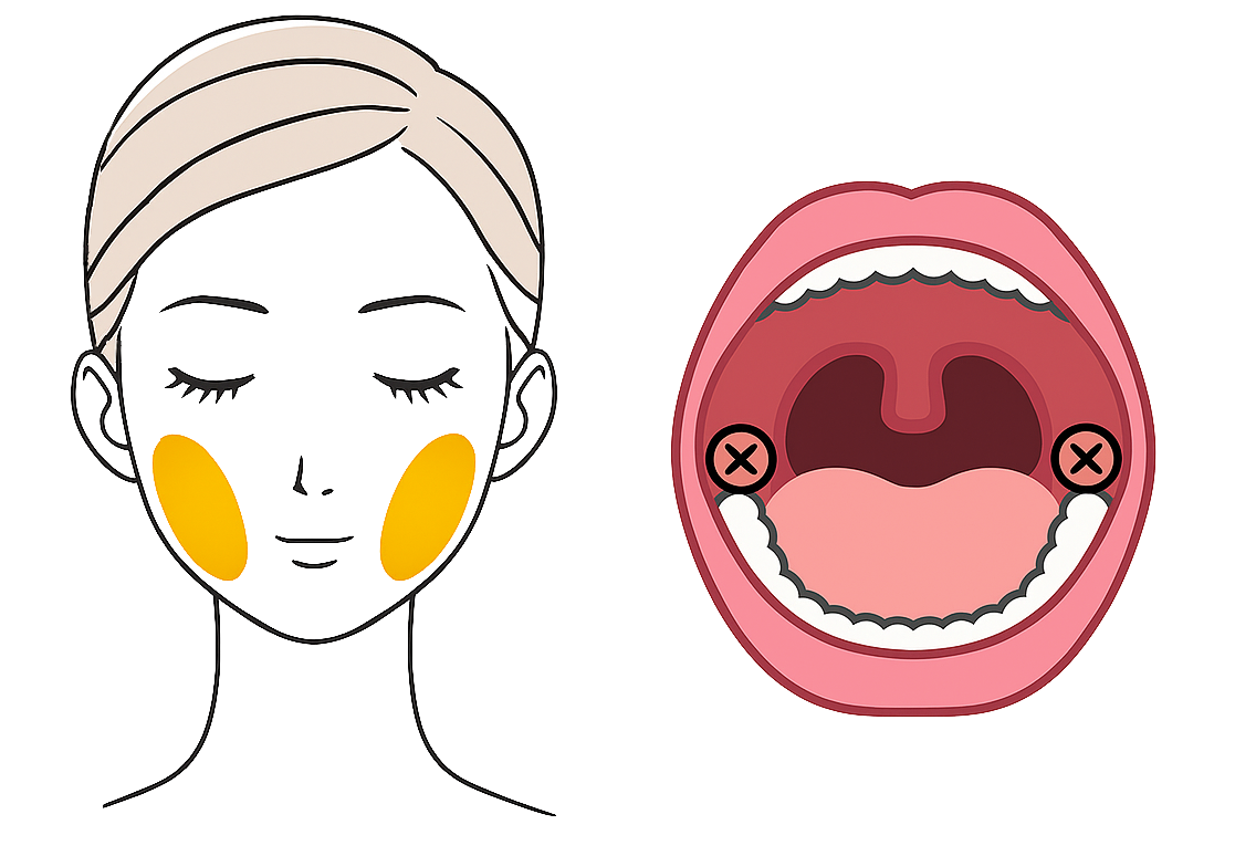 バッカルファット除去（プレミアム）のイメージ図