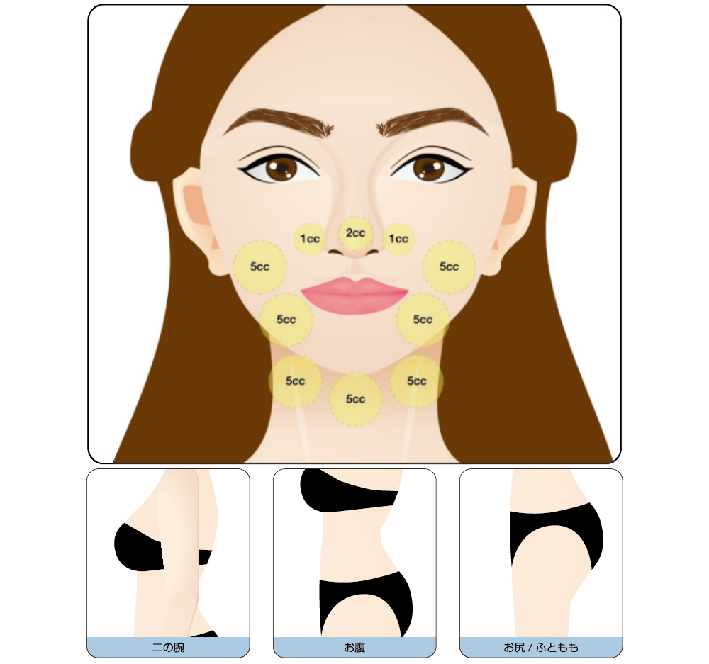 脂肪分解注射カベリン｜ファットエックスコアならボンボンクリニック 銀座駅前本院・渋谷院